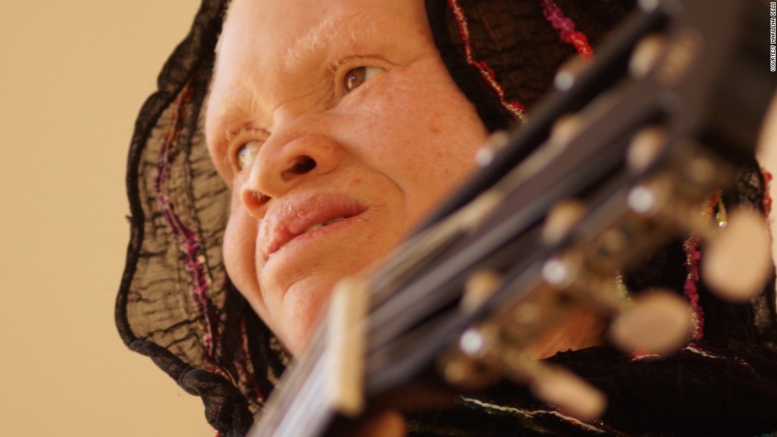 The result of those sessions, &quot;White African Power&quot; by the &quot;Tanzania Albinism Collective,&quot; has been released prior to the United Nation&#39;s third International Albinism Awareness Day. Among the artists featured is Thereza Phinias (pictured), who contributed three songs including the upbeat album closer &quot;Happiness.&quot;