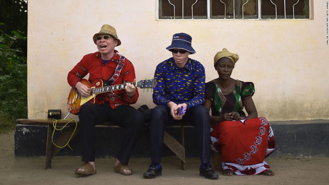 Albino singer King Shube plays a guitar on Ukerewe, 2016.  King Shube is an exception among the island&#39;s albino community. Many were actively discouraged from singing or banned according to music producer Ian Brennan, who visited the island and recorded sessions with locals in summer last year.