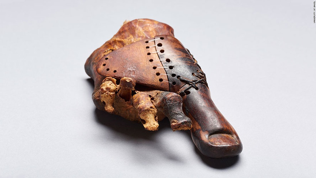 This prosthetic device was made for a priest&#39;s daughter who had to have her right big toe amputated 3,000 years ago. This &lt;a href=&quot;http://www.cnn.com/2017/06/22/health/ancient-egypt-wooden-toe-prosthetic-trnd/index.html&quot;&gt;surprisingly lifelike toe&lt;/a&gt; was made to look natural by a skilled artisan who wanted to maintain the aesthetic as well as mobility during the Early Iron Age. It was designed to be worn with sandals, the footwear of choice at the time.