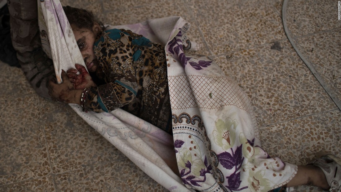 This injured girl was found by Iraqi forces as they &lt;a href=&quot;http://www.cnn.com/2017/06/29/middleeast/iraq-mosul-fighting/index.html&quot; target=&quot;_blank&quot;&gt;advanced against ISIS militants&lt;/a&gt; in the Old City of Mosul on Monday, July 3. She was carried away for medical assistance.