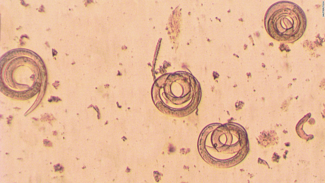 &lt;strong&gt;Trichinella spiralis:&lt;/strong&gt; If a human or animal eats meat infected with Trichinella cysts, the Centers for Disease Control and Prevention says, their stomach acid dissolves the hard covering of the cysts. The worms pass into the small intestine, where they lay eggs that develop into immature worms, which travel through the arteries and into the muscles. There, they curl up and return to the original cyst formation, and the life cycle continues. Symptoms can include nausea, diarrhea, vomiting, headaches, fevers, chills, cough, facial swelling, aching joints and muscle pain. 