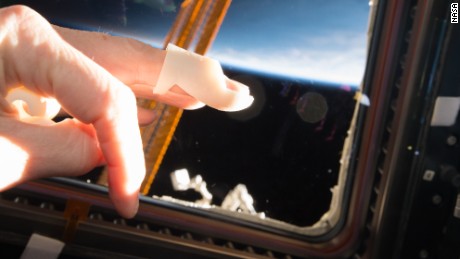 Mallet splint Caption: 3D4MD 3D-printed the first medical supplies onboard the International Space Station on January 11, 2017. 3D4MD crowdsources and creates cost-optimized printable designs of medical resources to treat an ill or injured astronaut on-site during a long space mission. 