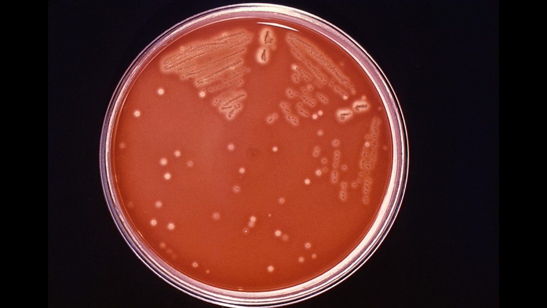 what-is-flesh-eating-bacteria-cnn-video