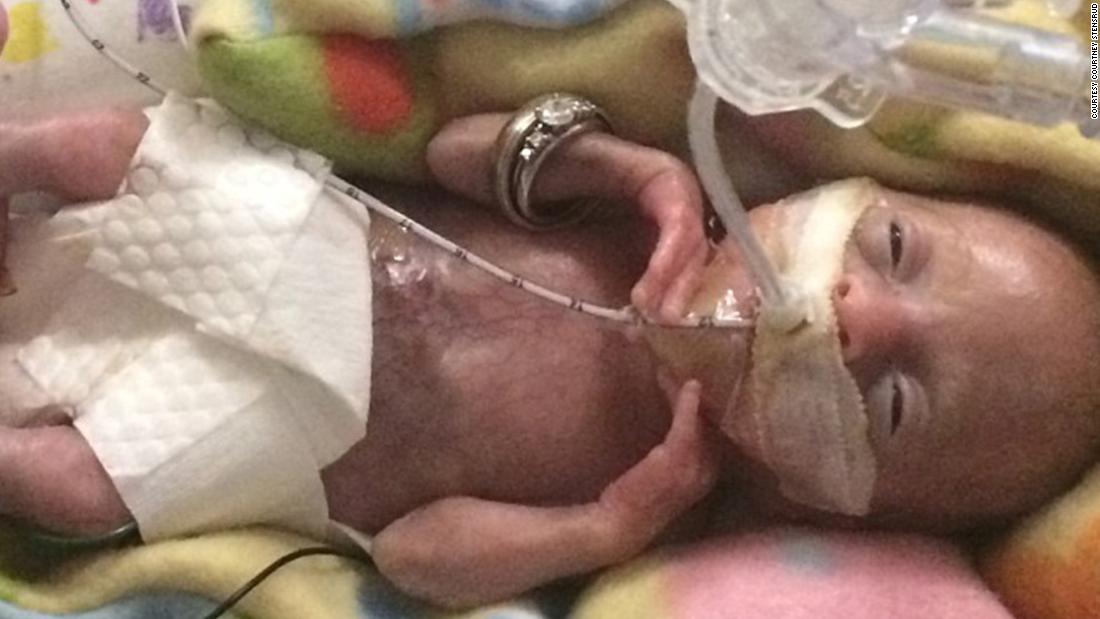 born-before-22-weeks-most-premature-baby-is-now-thriving