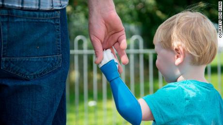 Dad designs and 3D prints a prosthetic arm for his son 