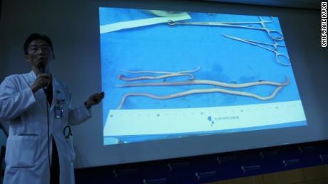 What parasitic worms in defector reveal about conditions in North Korea