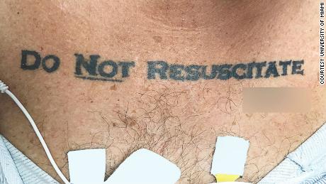 A Man S Do Not Resuscitate Tattoo Left Doctors Debating Whether To Save His Life Cnn
