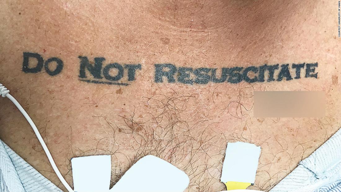 A man's 'Do not resuscitate' tattoo left doctors debating whether to save his life