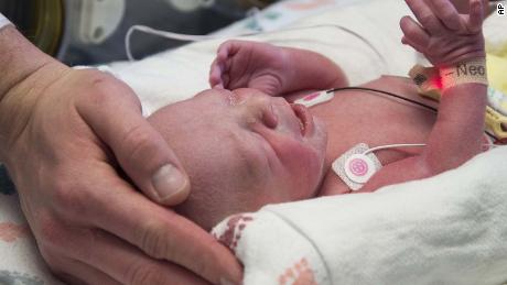 Baby is first to be born in US after uterus transplant, hospital says