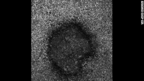 The adaptive optics image of Payne&#39;s retina revealed a crescent shape.