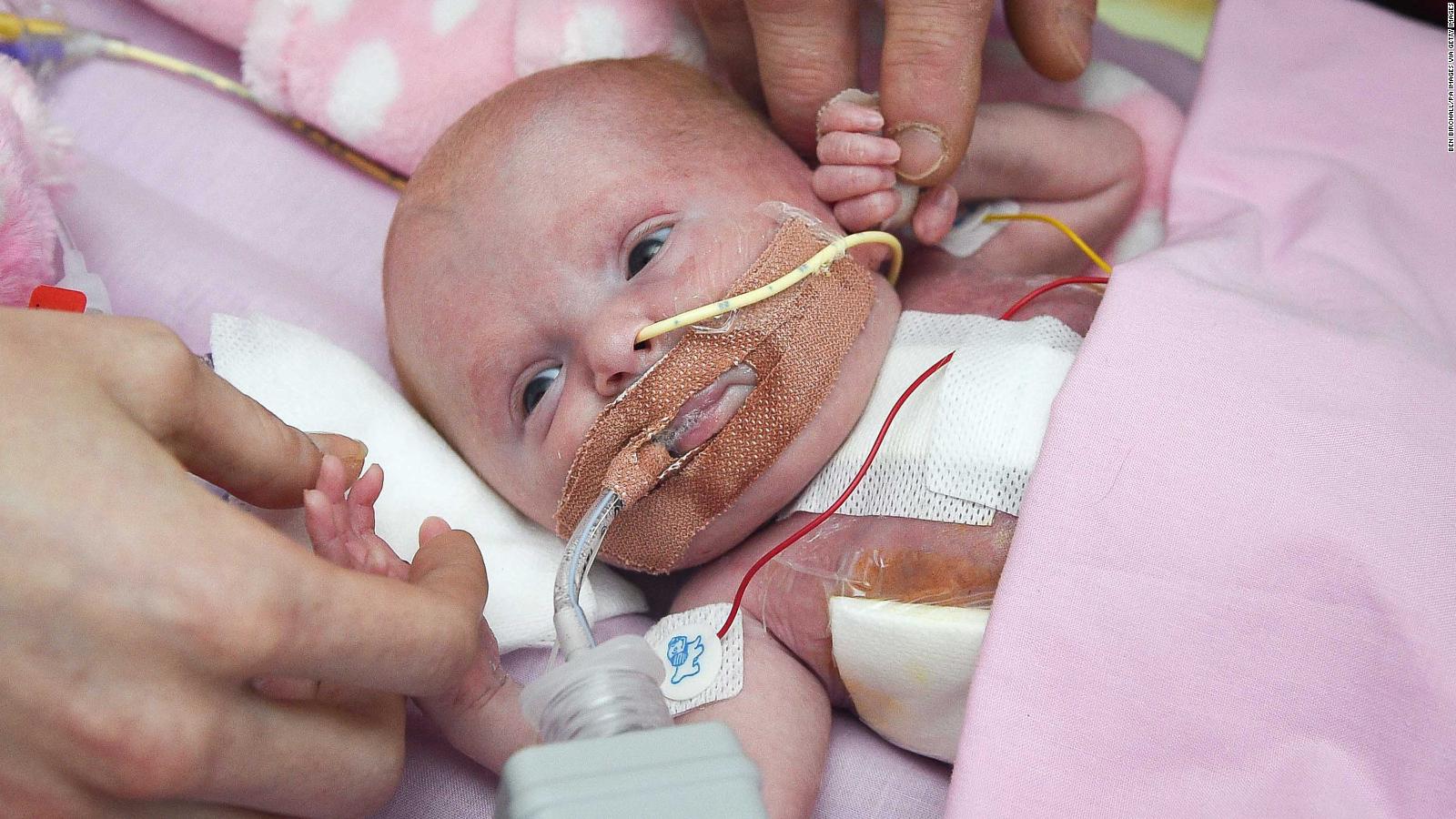 Baby Born With Heart Outside Her Body Survives Surgery Cnn