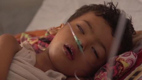 Yemen ravaged by years of war and famine