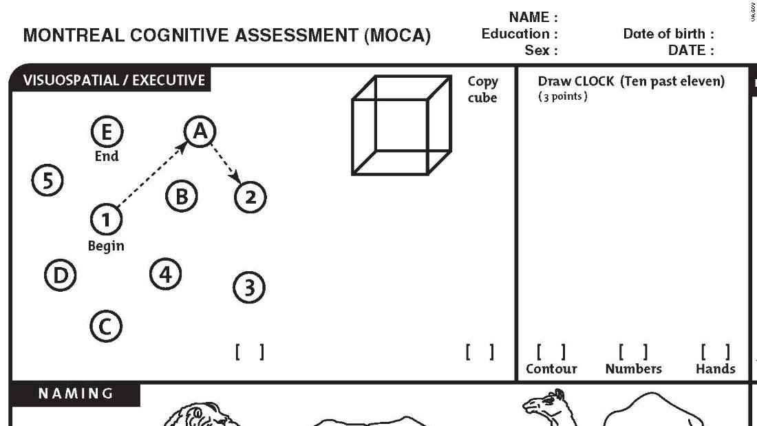 montreal cognitive assessment moca