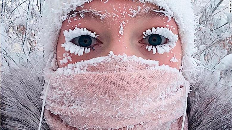 It's so cold here that eyelashes are freezing