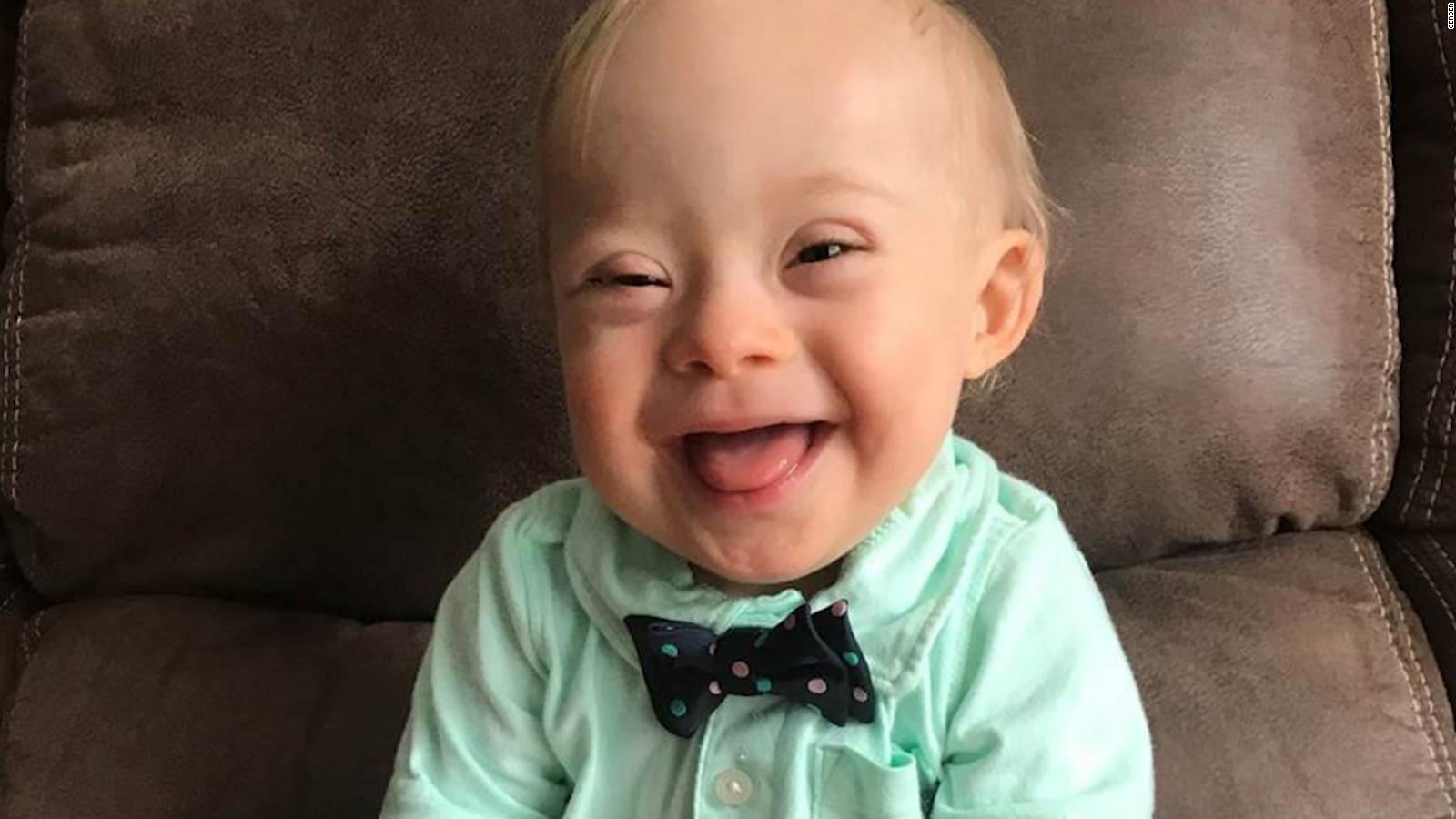 new gerber baby down syndrome