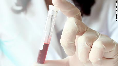 Blood test offers hope of finding cancers before symptoms develop