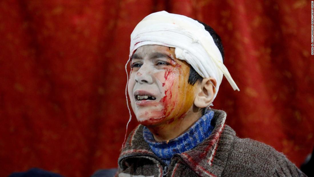 A boy waits to receive medical treatment at a field hospital on February 19.