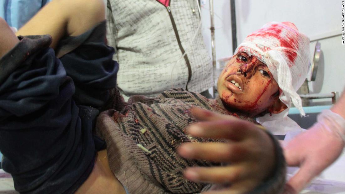 A wounded boy receives treatment in Douma following airstrikes on the village of Mesraba.