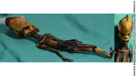 Researchers finally solve mystery of 'alien' skeleton