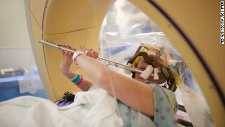 title: Musician Plays Flute During Deep Brain Stimulation duration: 00:00:35 site: Youtube author: null published: Wed Mar 28 2018 16:47:21 GMT-0400 (Eastern Daylight Time) intervention: yes description: Surgeons at Memorial Hermann-TMC performed a procedure to treat a patient's hand tremor.