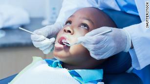 Fewer dental cavities found in young people, but minorities still most at risk