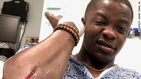 James Shaw Jr., 29, took a selfie of himself showing his injury as well as a bandaged hand. Shaw was able to wrestle an AR-15 style rifle away for the shooter. Shaw sustained minor injuries in the attack.