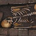01 ancient finds post mortem fetal extrusion