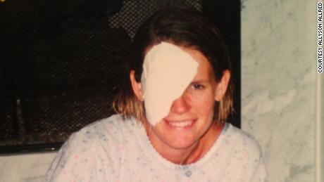 Allyson Allred after her eye was removed in 2001.