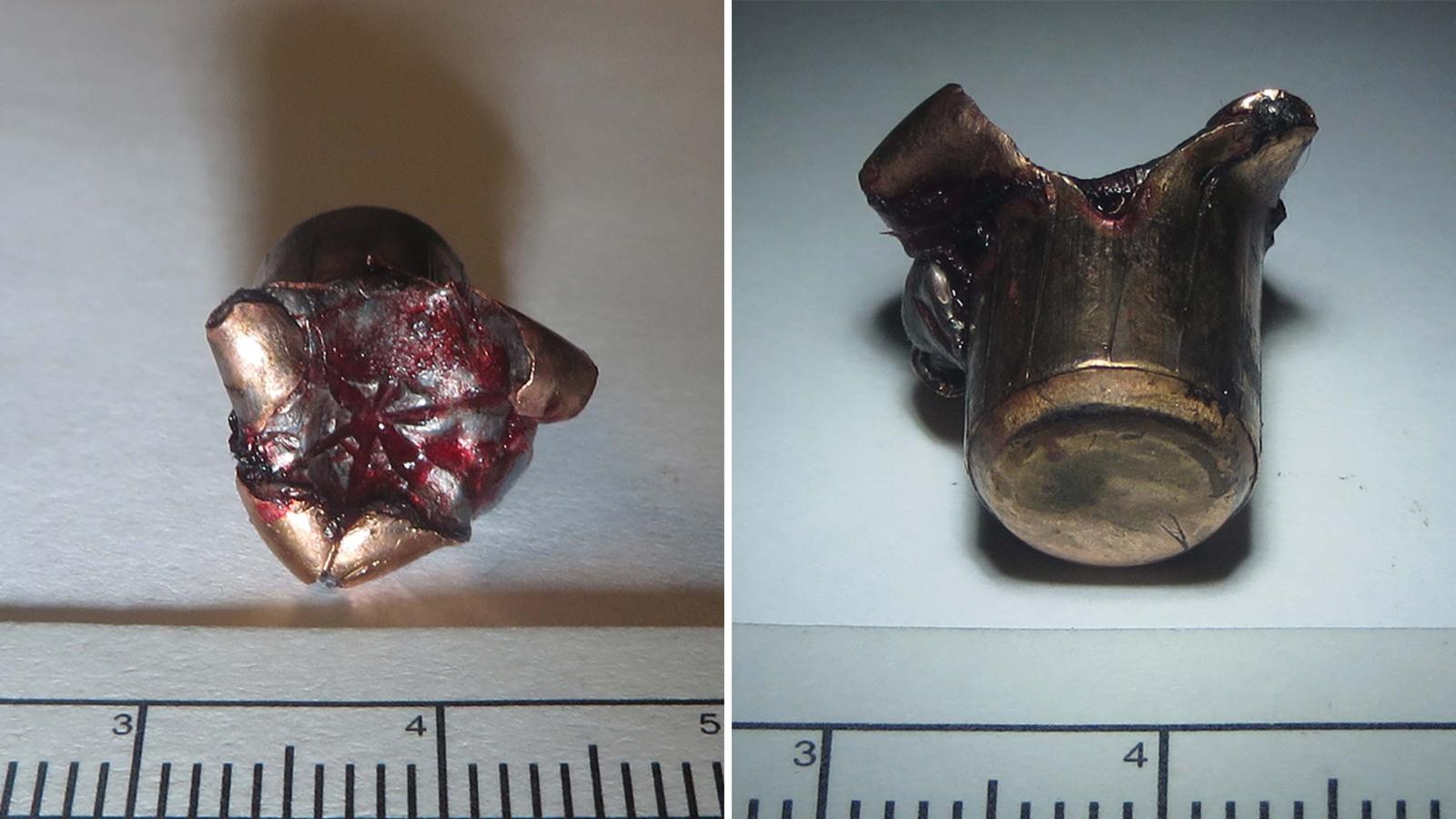 This 9 mm bullet allegedly tore through the left knee of Vincent Sheperis, a SWAT officer in Stamford, Connecticut. His P320 fired when he dropped it, he claims.