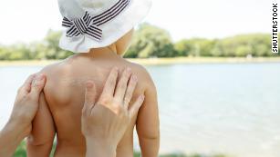 Sunscreen and sun protection: everything you need to know