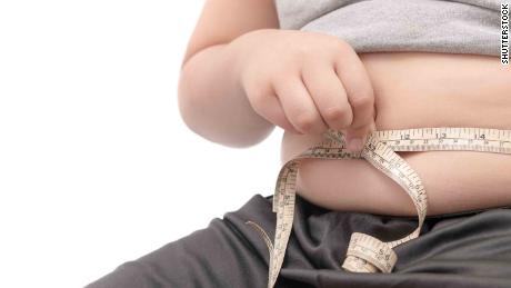 Childhood obesity is high in home of Mediterranean diet