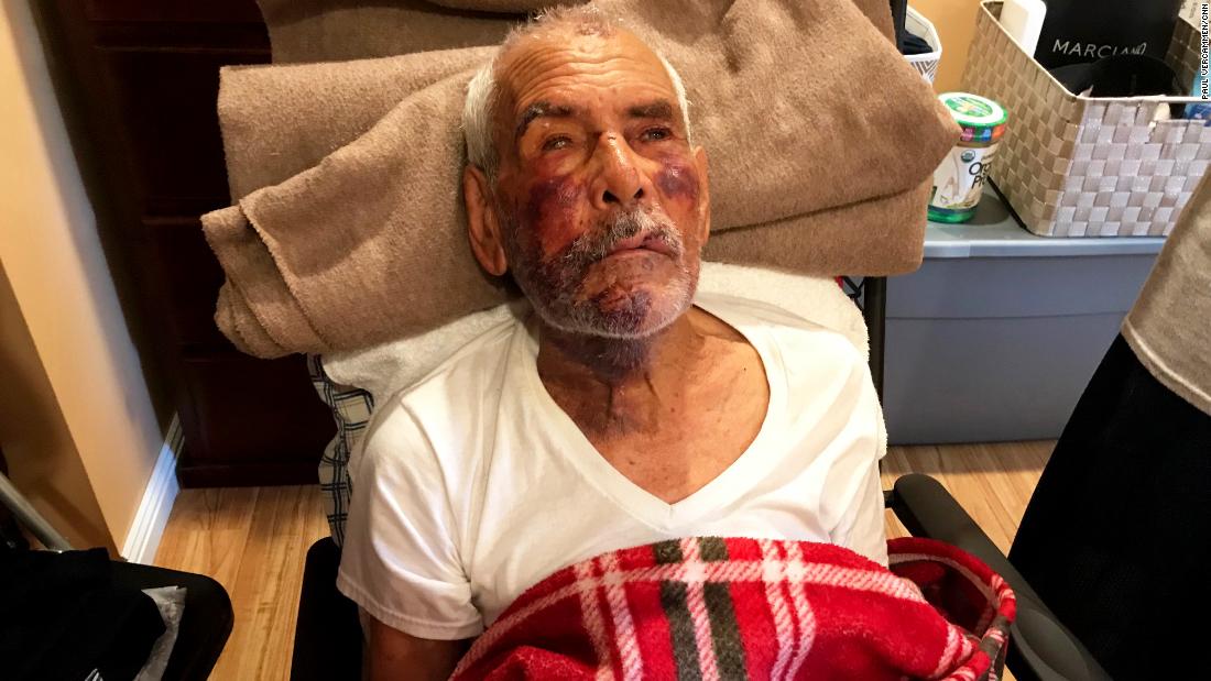 man beaten with brick, told 'go back to Mexico' |