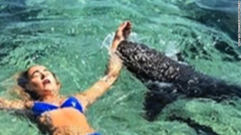 Shark Bites Instagram Model On Vacation