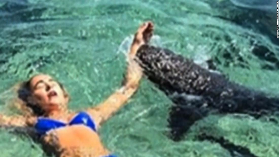 Shark Bites Instagram Model Posing In The Bahamas Cnn