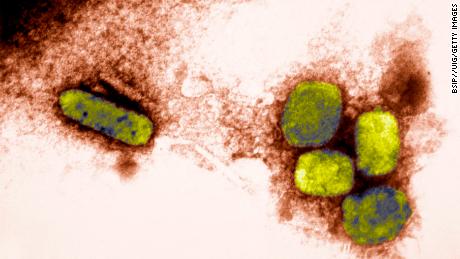 FDA approves the first drug to treat smallpox