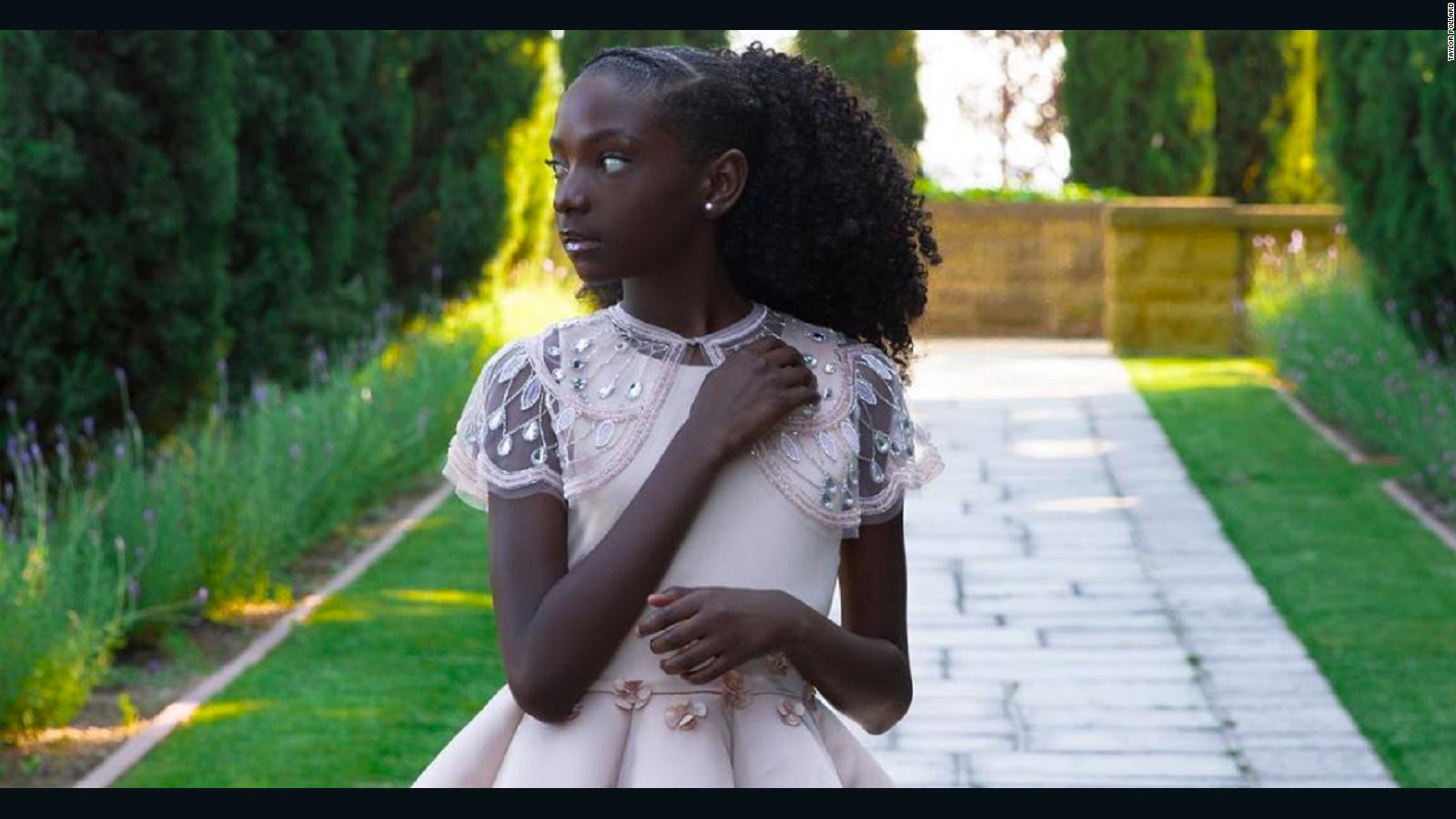 This 11 Year Old Was Bullied For Her Skin Color Now She Owns A 