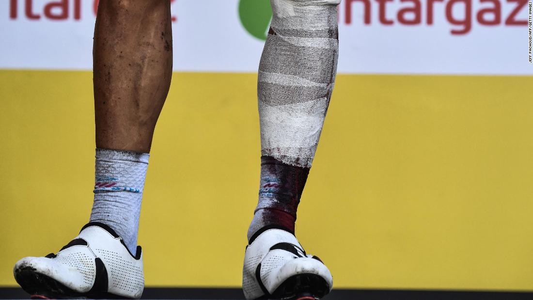 Belgium&#39;s Philippe Gilbert stands on the podium after the 16th stage on Tuesday, July 24. He injured his leg in a crash and had to bow out of the Tour.
