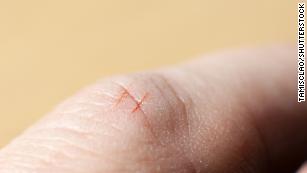 Paper Cuts, Why So Painful?  amomentofscience - Indiana Public Media