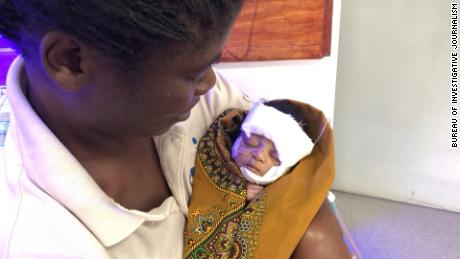 Scourge of superbugs killing Malawi's babies