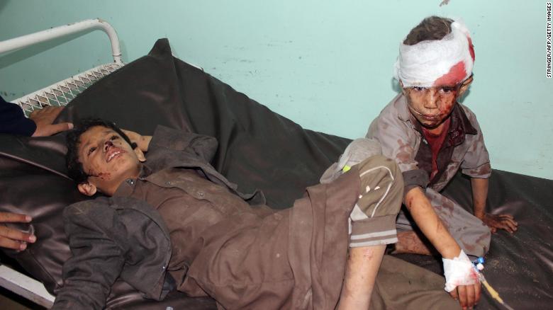 Yemeni children receive treatment at a hospital after being wounded in the August 9 strike.