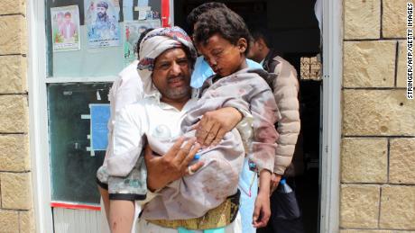 A man carries a wounded child in the aftermath of the attack. 