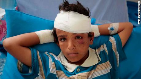 One of the children injured in Thursday&#39;s attack. 