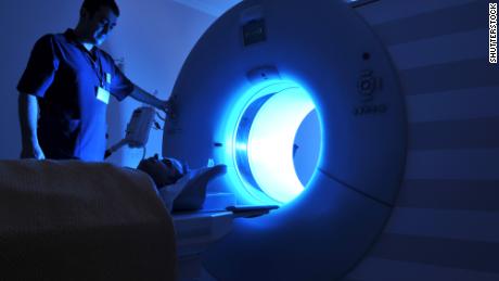 MRI screening for women with extremely dense breast tissue reduces interval cancer