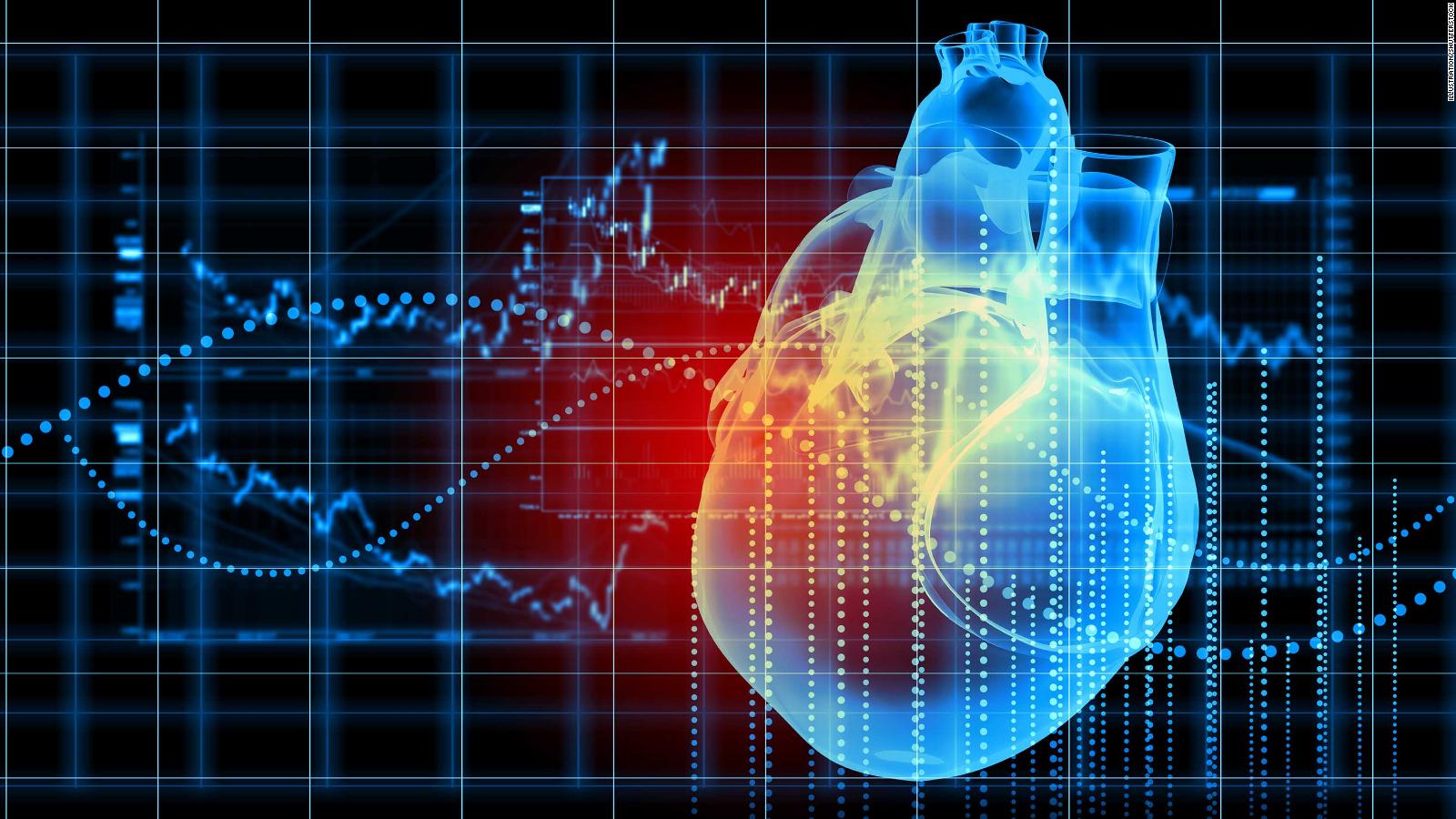 blood-pressure-how-it-impacts-risk-of-heart-attack-and-stroke-cnn