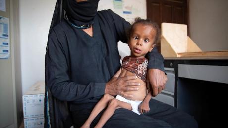 British NGO Save the Children warns that millions of children are at risk of famine in the war in Yemen.