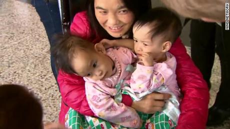 The twins and their mother arrive at Melbourne airport in Australia, prior to their life-changing surgery.