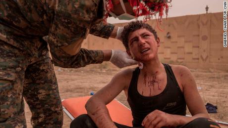 A young SDF soldier receives first aid on the frontline during the operation in Sousa, on October 25.