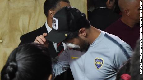 Pablo Perez is surrounded by police officers after receiving medical treatment in a hospital due to an eye injury caused by River Plate fans.