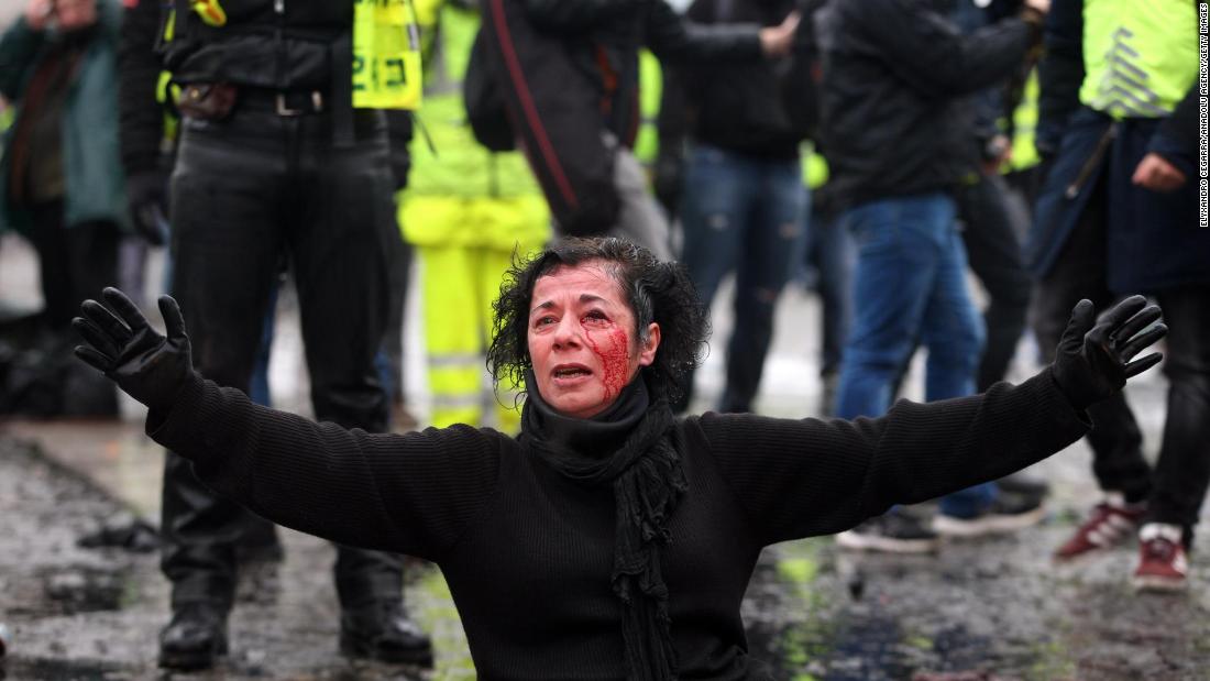 An injured woman sits on the ground as police officers spray yellow vest protesters with tear gas during a protest in Paris on December 1.