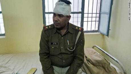 An Indian policeman looks on after receiving treatment for a head injury following reports of mob violence at Chingravati village in Bulandshahr, on December 3, 2018. 